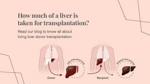 All About Becoming a Liver Donor