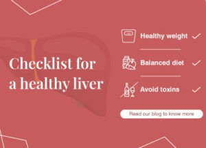 Non-alcoholic Fatty Liver: Symptoms, Causes and Treatment