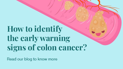 Colon cancer – Symptoms and causes