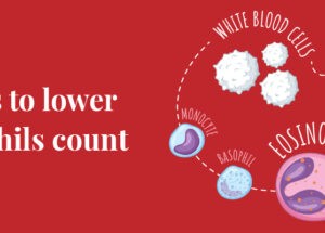 How to reduce eosinophil count