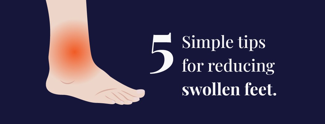 How to reduce swelling in feet